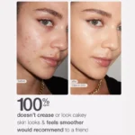 Before and after photo of a woman with acne, showing full coverage results using Tarte Shape Tape Concealer 16N Fair Light Neutral.