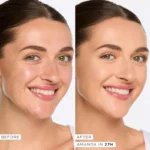 Before and after using Tarte Shape Tape Concealer for dark circles