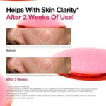 Before and after skin clarity comparison using Anua 10% Niacinamide + 4% TXA Serum, showcasing improved brightness and texture.